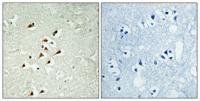 GCP5 Polyclonal Antibody