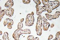 GCSm-γ Polyclonal Antibody
