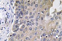 GCS-α-1 Polyclonal Antibody