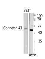 Doublecortin Polyclonal Antibody