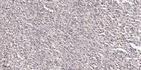 Doublecortin Polyclonal Antibody