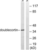 Doublecortin Polyclonal Antibody
