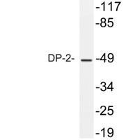 DP-2 Polyclonal Antibody