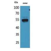 DPP7 Polyclonal Antibody
