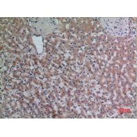 DPP7 Polyclonal Antibody