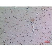 DPP7 Polyclonal Antibody