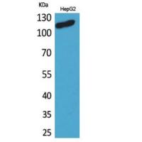 DPYD Polyclonal Antibody