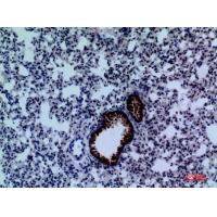 DPYD Polyclonal Antibody