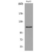 DPYD Polyclonal Antibody