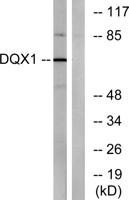 DQX1 Polyclonal Antibody