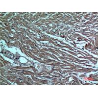 DR3 Polyclonal Antibody
