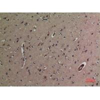 DR3 Polyclonal Antibody