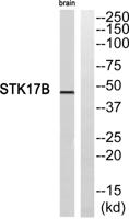 DRAK2 Polyclonal Antibody