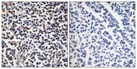 DRAK2 Polyclonal Antibody