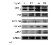 DRAM1 Polyclonal Antibody