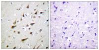 DREAM Polyclonal Antibody