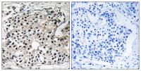 DRS-1 Polyclonal Antibody