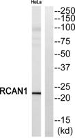 DSCR 1 Polyclonal Antibody