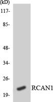 DSCR 1 Polyclonal Antibody