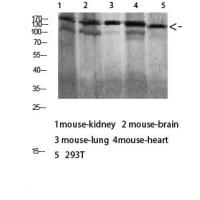 Dsg1 Polyclonal Antibody