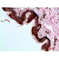 Dsg1 Polyclonal Antibody