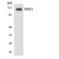 Dsg1 Polyclonal Antibody