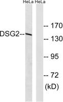 Dsg2 Polyclonal Antibody