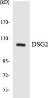 Dsg2 Polyclonal Antibody