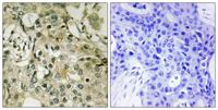 dTMP Kinase Polyclonal Antibody