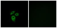 Duffy Polyclonal Antibody