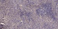 DYHC1 Polyclonal Antibody