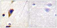 Dynamin I Polyclonal Antibody