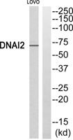 Dynein IC2 Polyclonal Antibody
