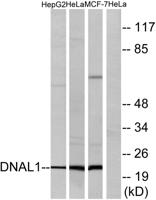 Dynein LC 1 Polyclonal Antibody