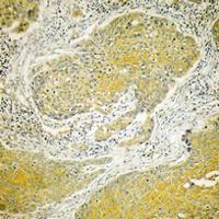 Dynein LC 2 Polyclonal Antibody