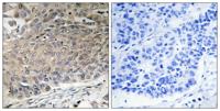 Dynein LC 2 Polyclonal Antibody