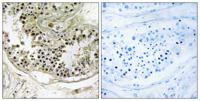 Dynein LC 2B Polyclonal Antibody