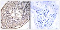 Dynein LC 4 Polyclonal Antibody