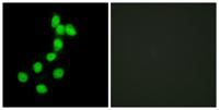 Dyrk1A Polyclonal Antibody
