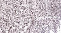 Dyrk1A Polyclonal Antibody