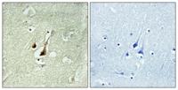 Dyrk1B Polyclonal Antibody
