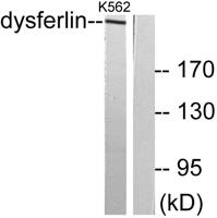 Dysferlin Polyclonal Antibody