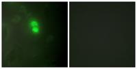 Dyskerin Polyclonal Antibody