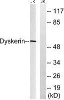 Dyskerin Polyclonal Antibody