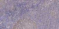 Dyskerin Polyclonal Antibody