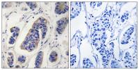 DZIP3 Polyclonal Antibody