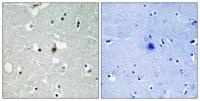E2A Polyclonal Antibody