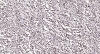E2F-2 Polyclonal Antibody