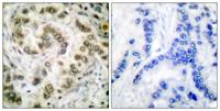 E2F-4/5 Polyclonal Antibody