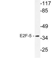 E2F-5 Polyclonal Antibody
